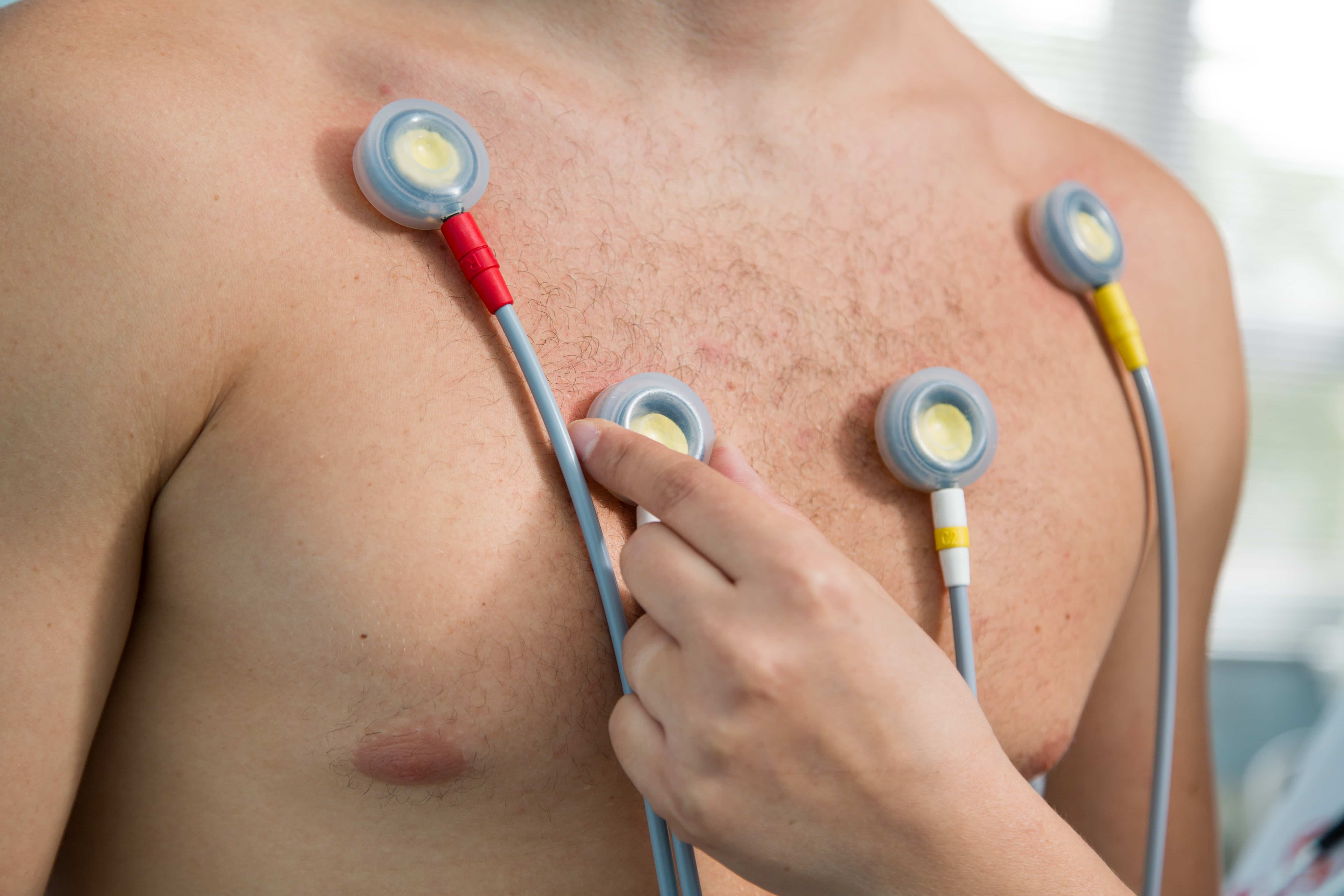 Photo-2 - Poliklinika Medikol Precizna kardiološka obrada bez čekanja