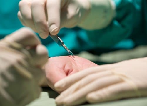 operacijska sala za estetsku kirurgiju