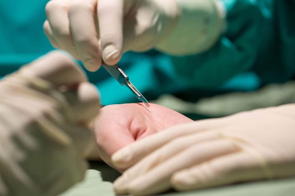 KARPALNI-KANAL-OP.-3 - Poliklinika Medikol operacijska sala za estetsku kirurgiju