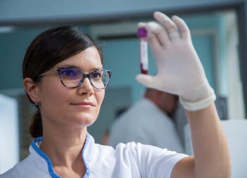 NOVI KVANTITATIVNI TEST IgG II NAKON CIJEPLJENJA U POLIKLINICI MEDIKOL