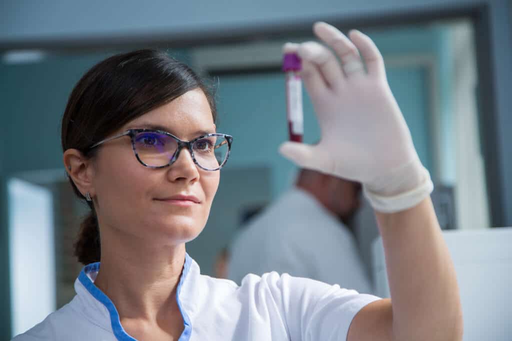 NOVI KVANTITATIVNI TEST IgG II NAKON CIJEPLJENJA U POLIKLINICI MEDIKOL