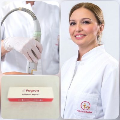 Laser-Genesis-e1571647594346 - Poliklinika Medikol Laser Genesis - brzo i učinkovito pomlađivanje