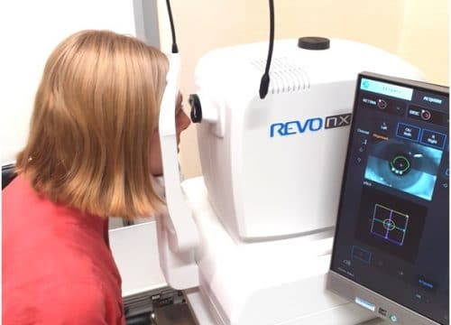 Novi OCT omogućuje precizniju očnu dijagnostiku