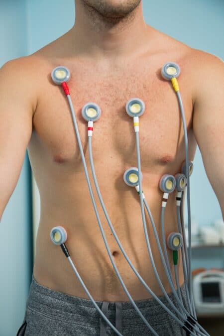 kardiologija-Osijek-e1612267274634 - Poliklinika Medikol