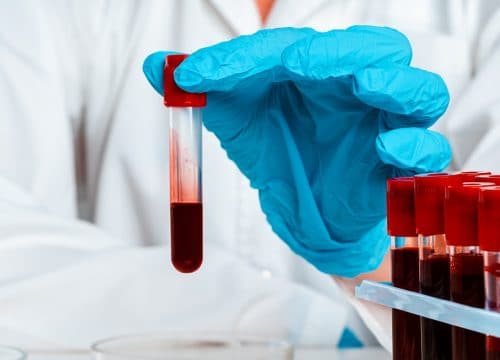 testiranje na COVID-19 antitijela