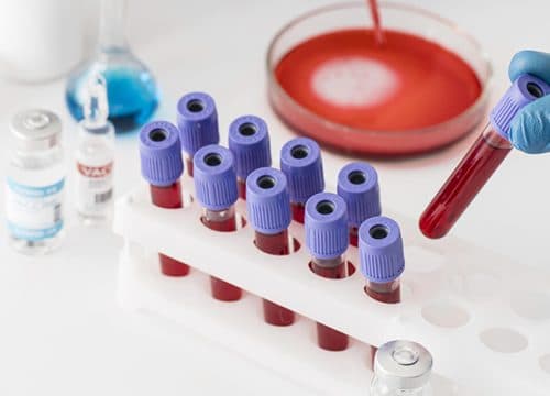 Vađenje krvi na vašoj lokaciji