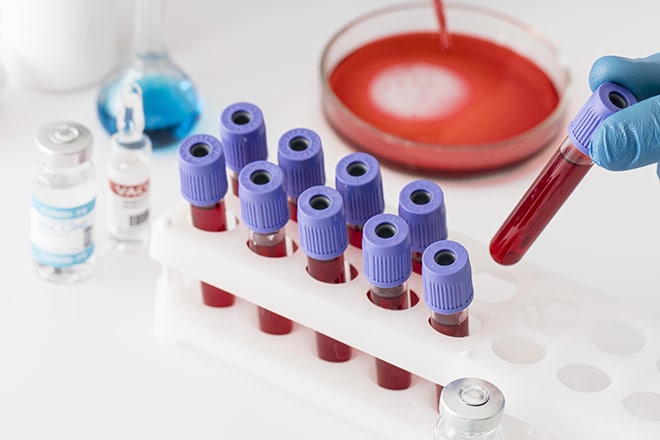 Vađenje krvi na vašoj lokaciji