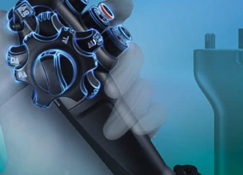 gastroenterologija Zagreb