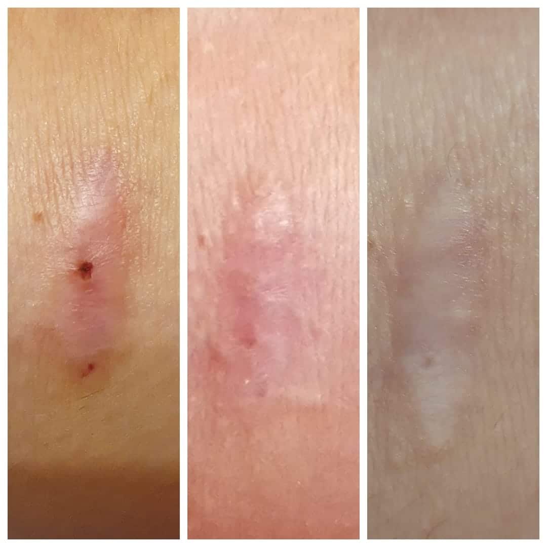 Miofascijalna terapija - Poliklinika Medikol