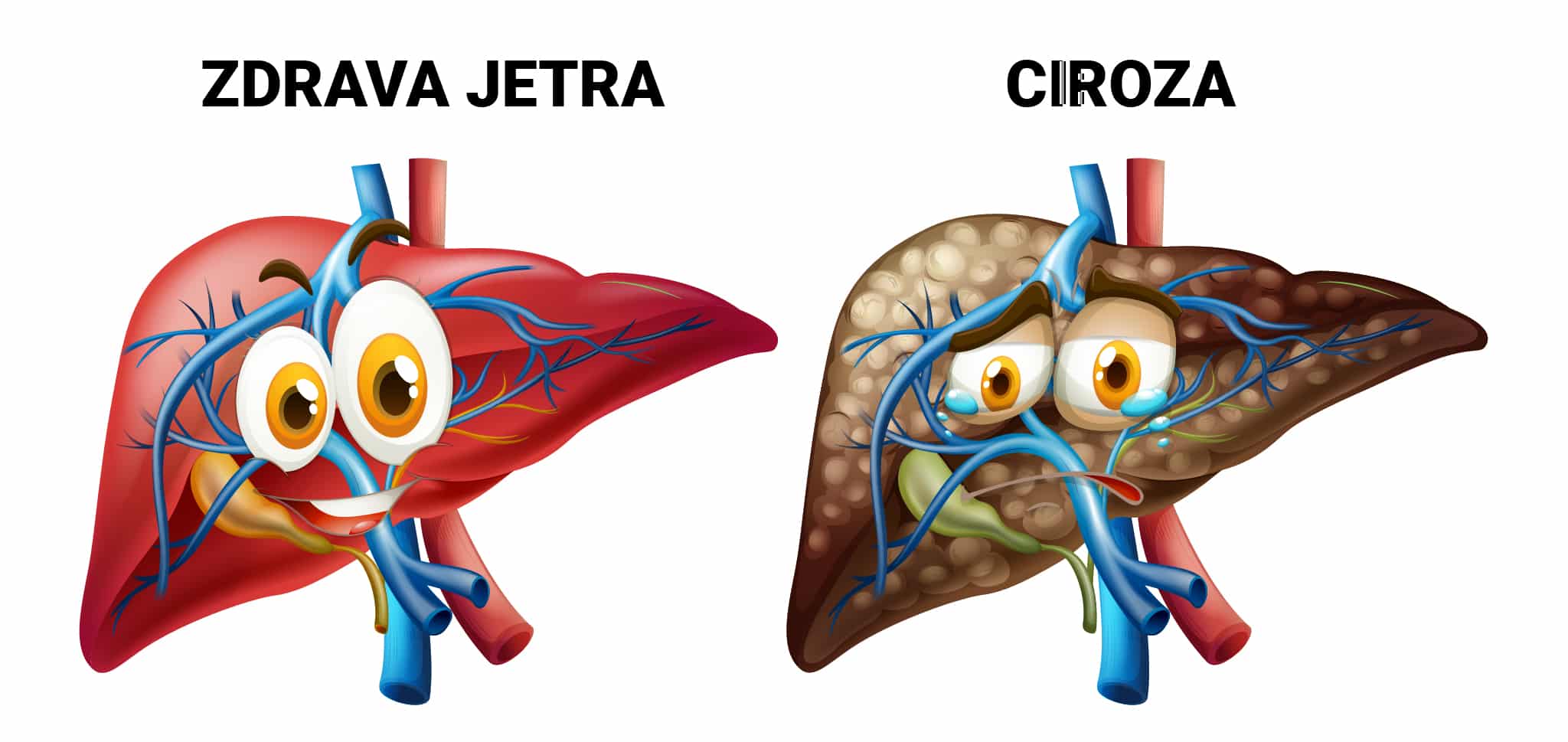 Masna Jetra - Poliklinika Medikol Masna Jetra i Ciroza