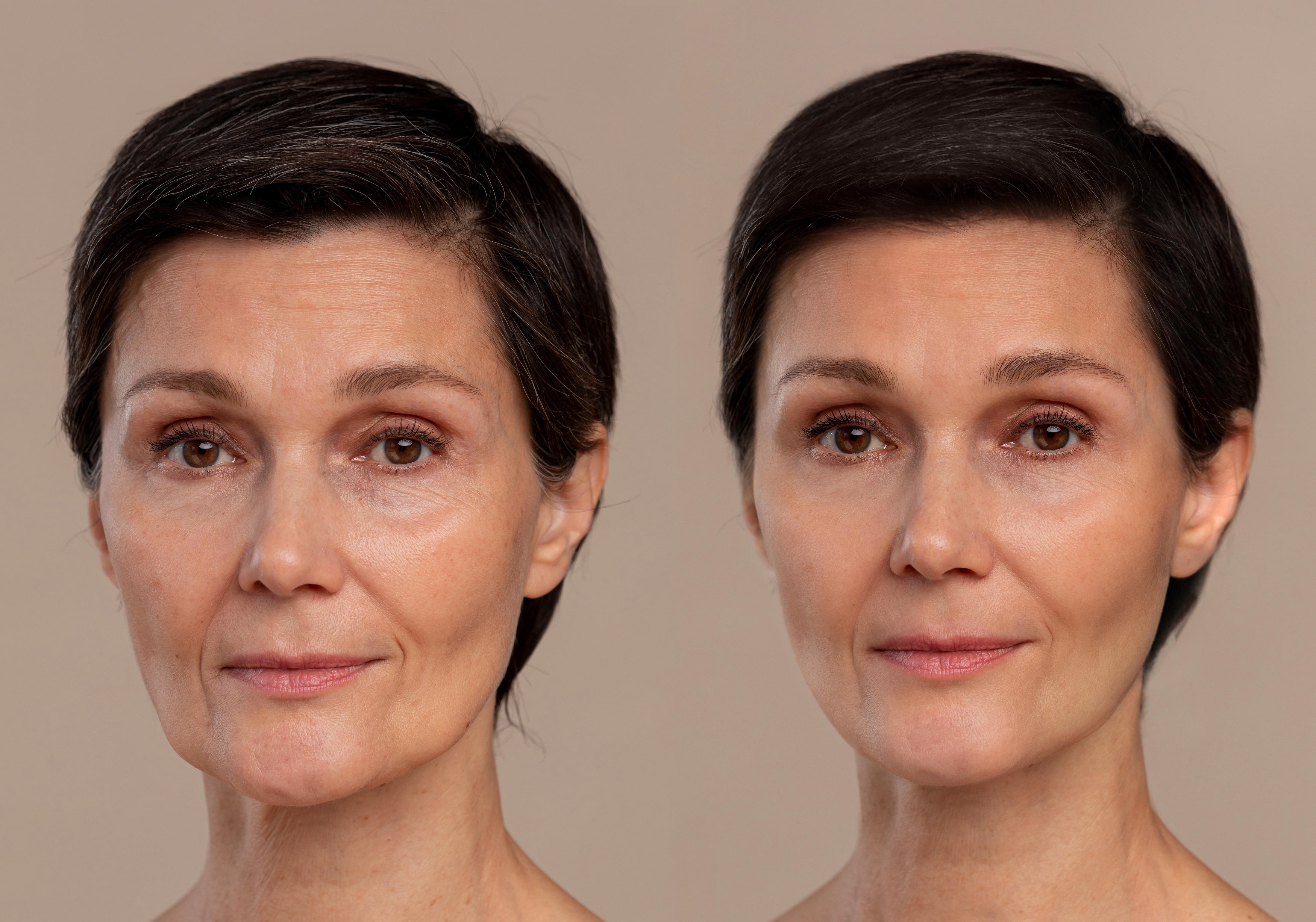 antiaging terapija
