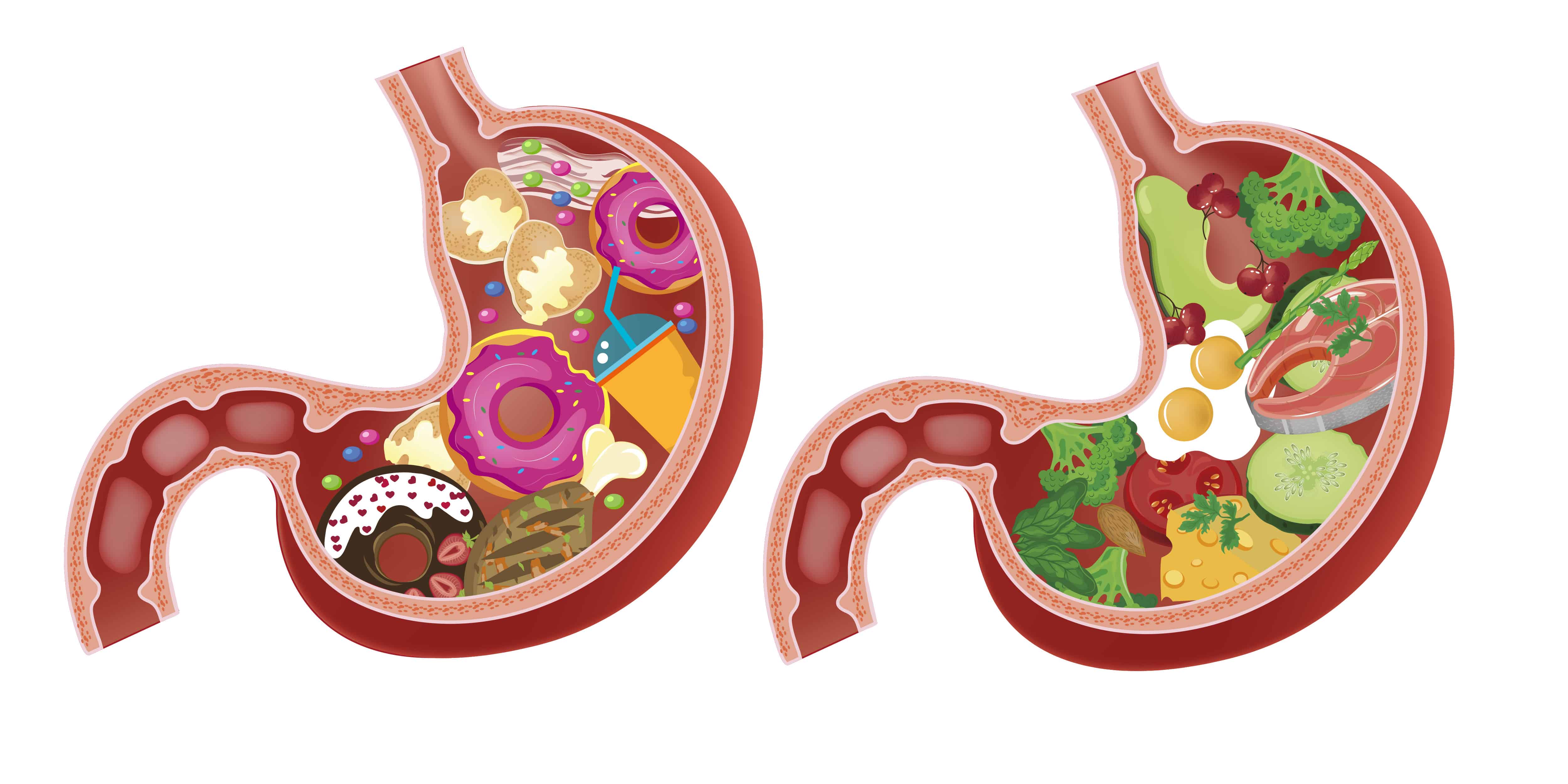 Jedinstven plan prehrane ne postoji