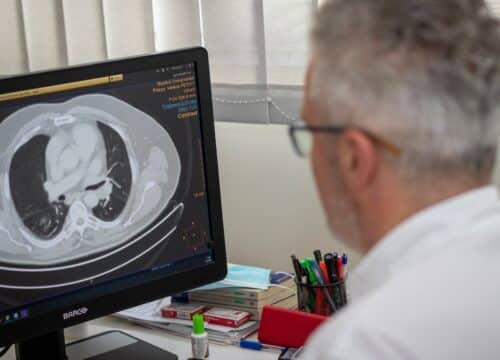 low dose CT pluća Medikol