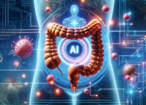 Umjetna inteligencija za otkrivanje polipa debelog crijeva