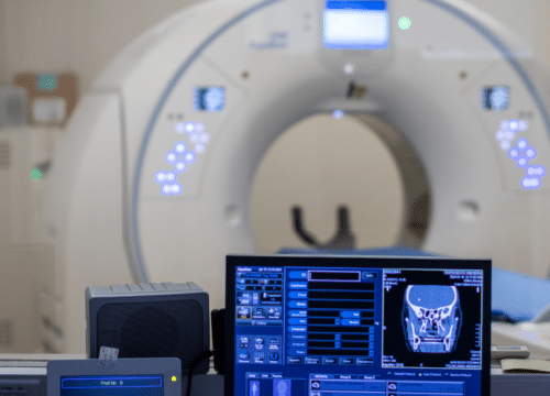 MSCT kolonografija, virtualna kolonoskopija