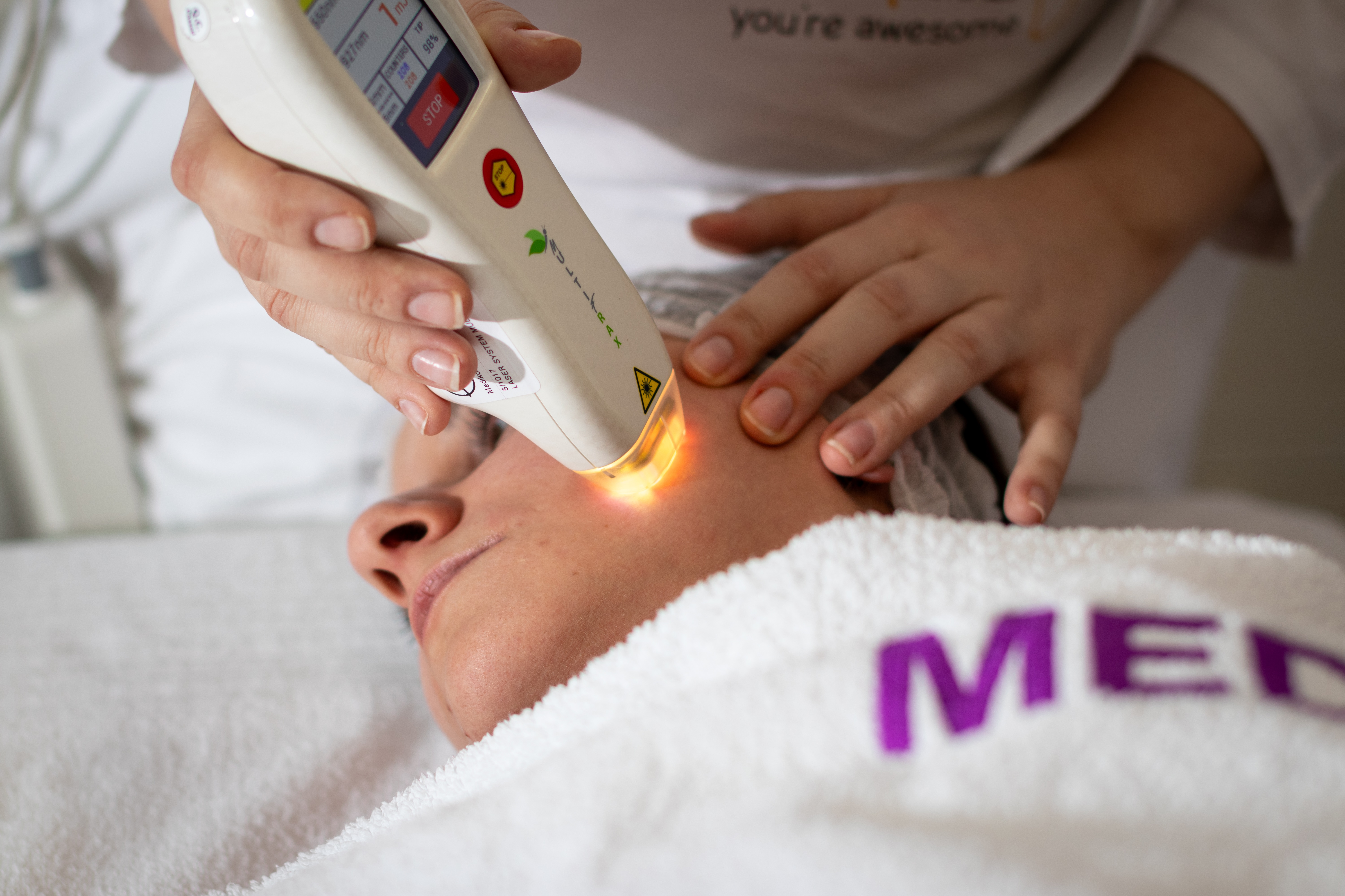 MultiFrax - Poliklinika Medikol MultiFrax laser za pomlađivanje kože