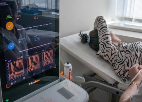 neinvazivna dijagnostika jetre