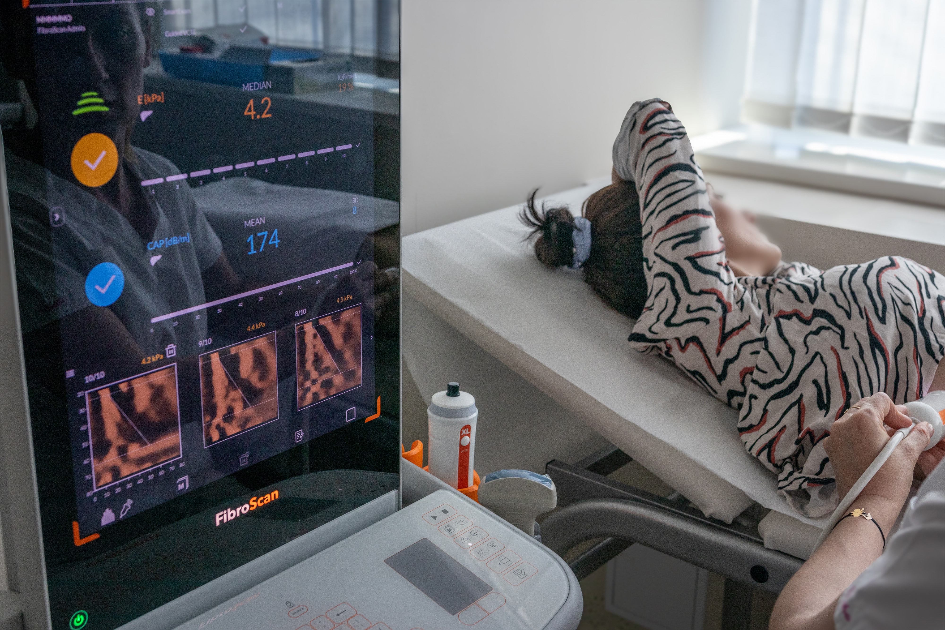 IMG_8892 web - Poliklinika Medikol neinvazivna dijagnostika jetre