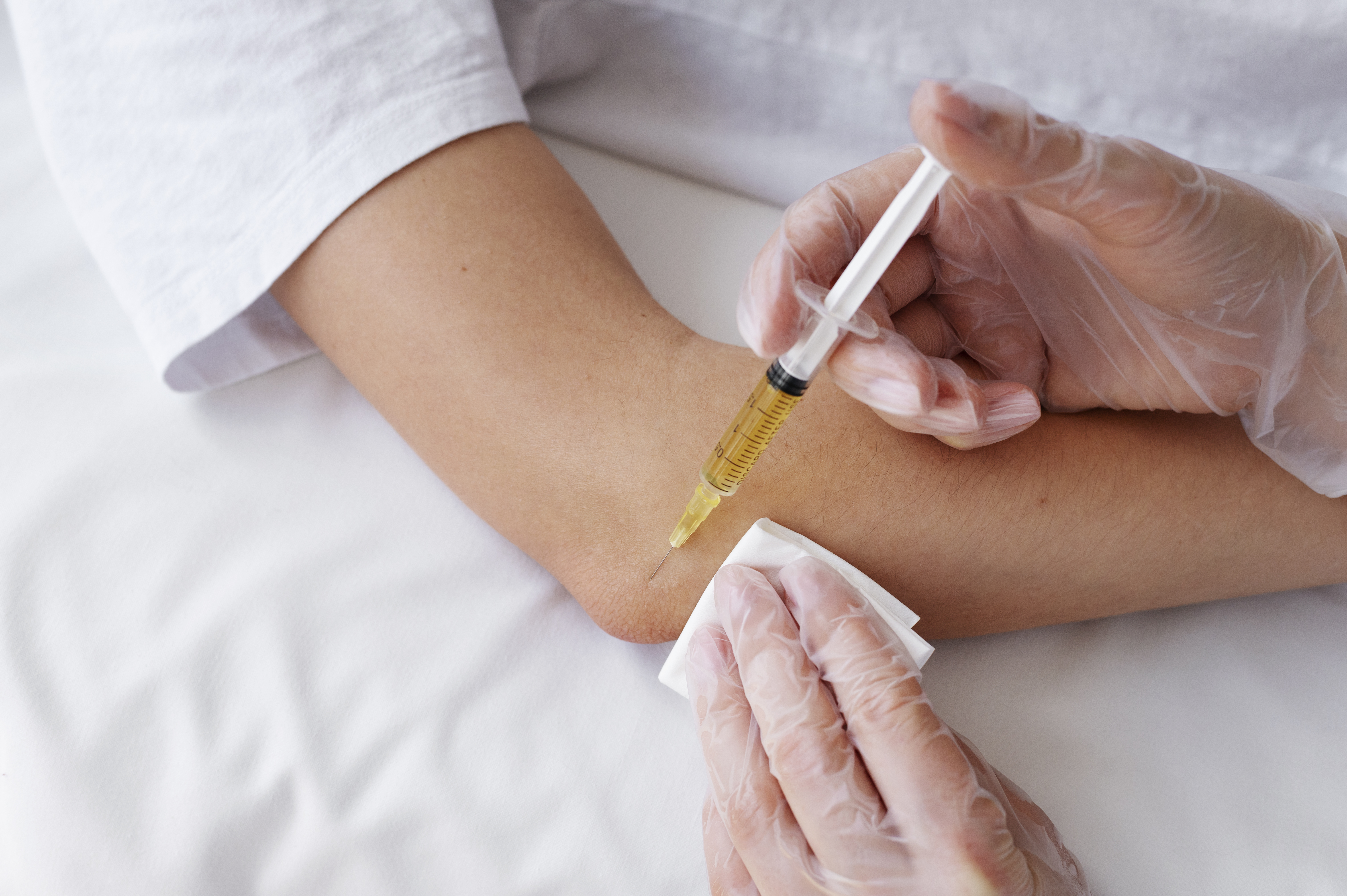 PRP terapija lakta - Poliklinika Medikol PRP terapija lakta